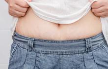 7 Tips Menghilangkan Stretch Marks, Mudah Dilakukan Semua Orang