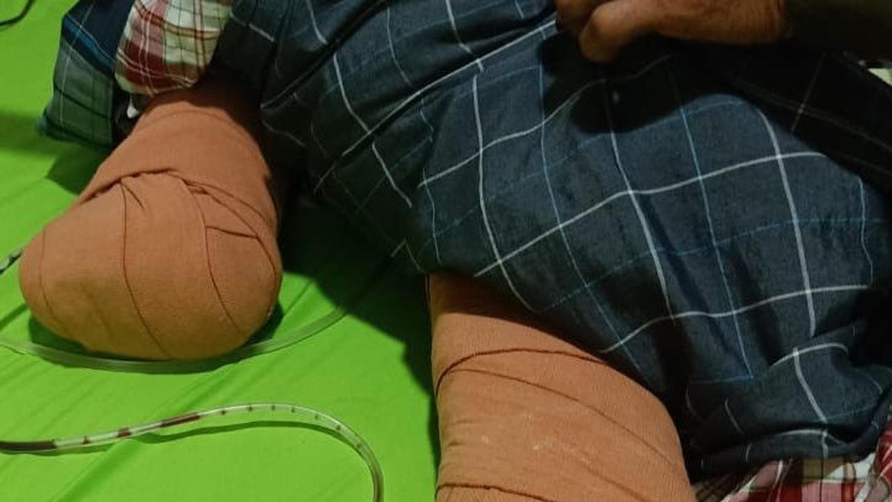 Detik-Detik Menegangkan Nabila Febrianti Selamatkan Kucing Lalu Tertabrak Truk, Berujung Kaki Diamputasi