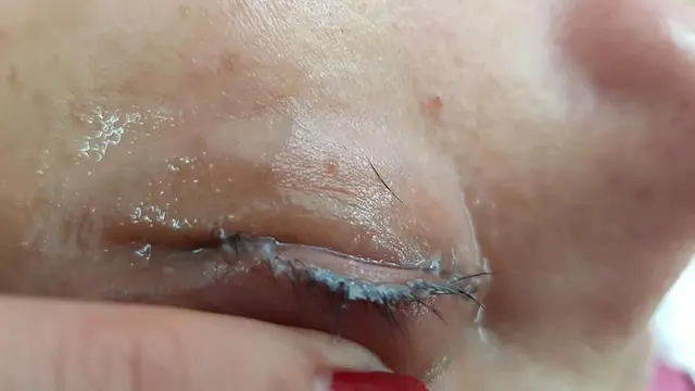 [Bintang] Pasang Extension Bulu Mata, Mata Perempuan Ini Malah Bengkak