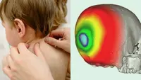 Mengubah bentuk kepala bayi (Sumber: Ilustrasi Pexels, Universitas Kyushu)
