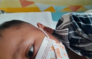 Kemenkes: Influenza A H1N1 Dominan di Indonesia