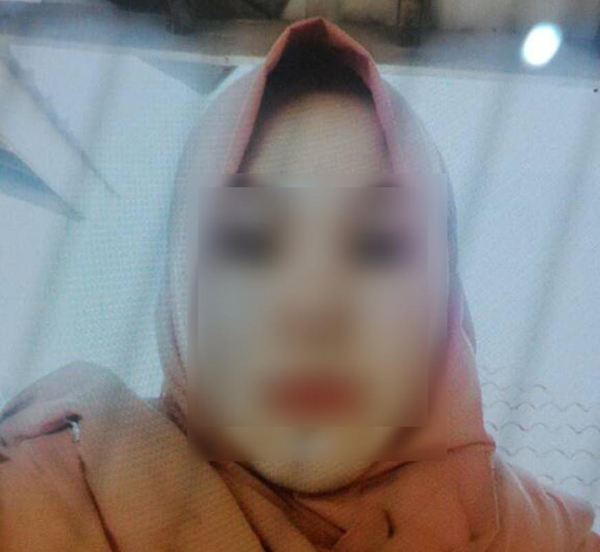 Dewi, ibu rumah tangga di Garut, Jawa Barat, yang digilas truk hingga tewas oleh sang suami. (Liputan6.com/Jayadi Supriadin)