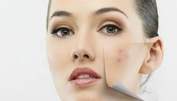 Arti Rizz: Fenomena Bahasa Gaul yang Viral di Media Sosial - Feeds ...