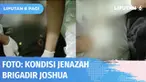 Sejumlah luka-luka jenazah yang diungkap pengacara keluarga, rupanya tak kunjung terjawab oleh penyelidikan polisi. Tim Liputan 6 SCTV, mendapatkan foto-foto sejumlah luka-luka di jenazah Brigadir Joshua pasca autopsi dilakukan.