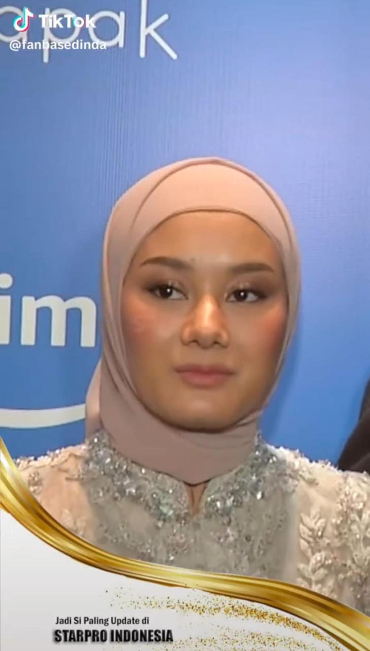 Wajah Dinda Hauw Jadi Sorotan