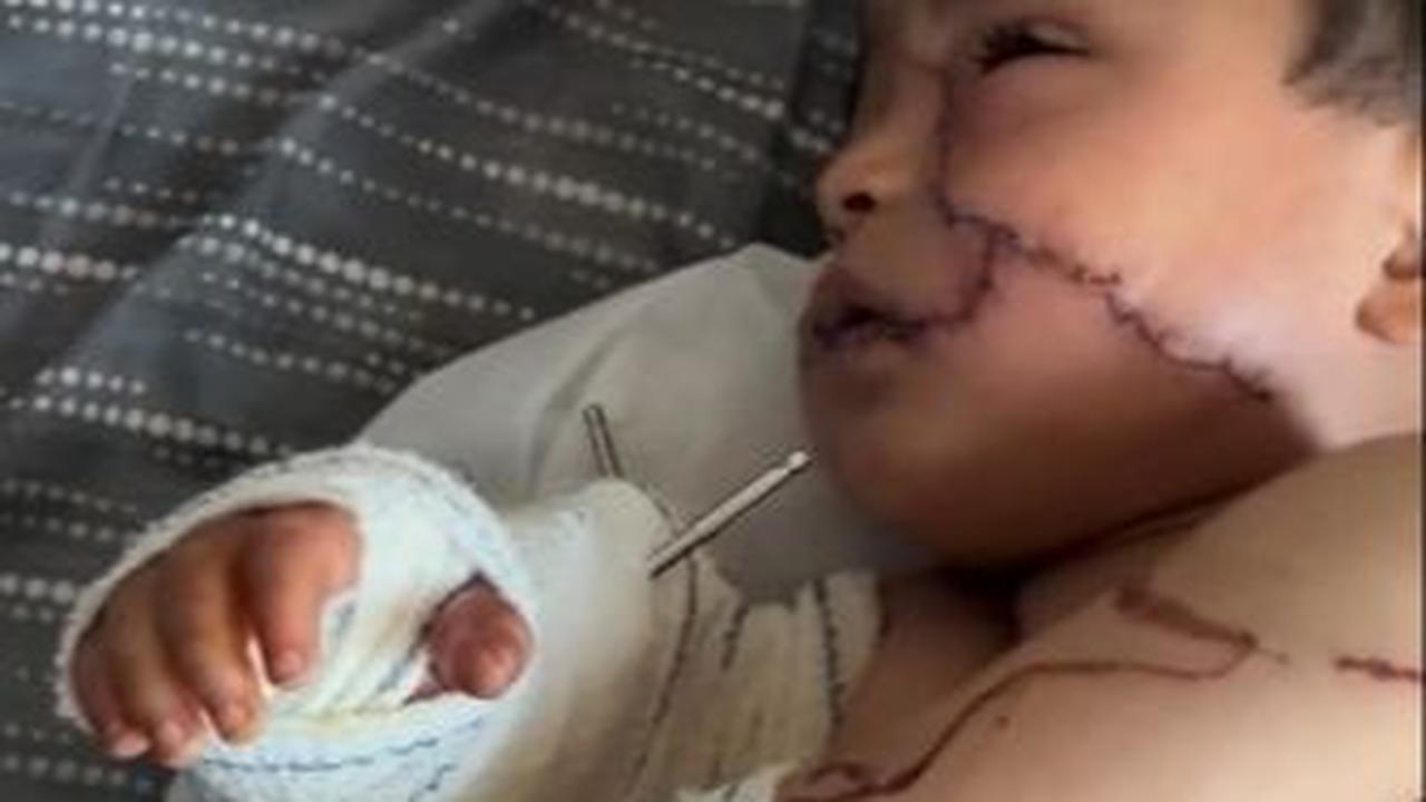 "Anak kecil Sanad Alarabi terluka parah akibat pemboman Israel di Gaza," tulis keterangan unggahan.