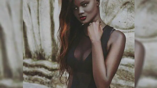  Miliki Kulit Melanin, Gadis Ini Malah Jadi Model Terkenal