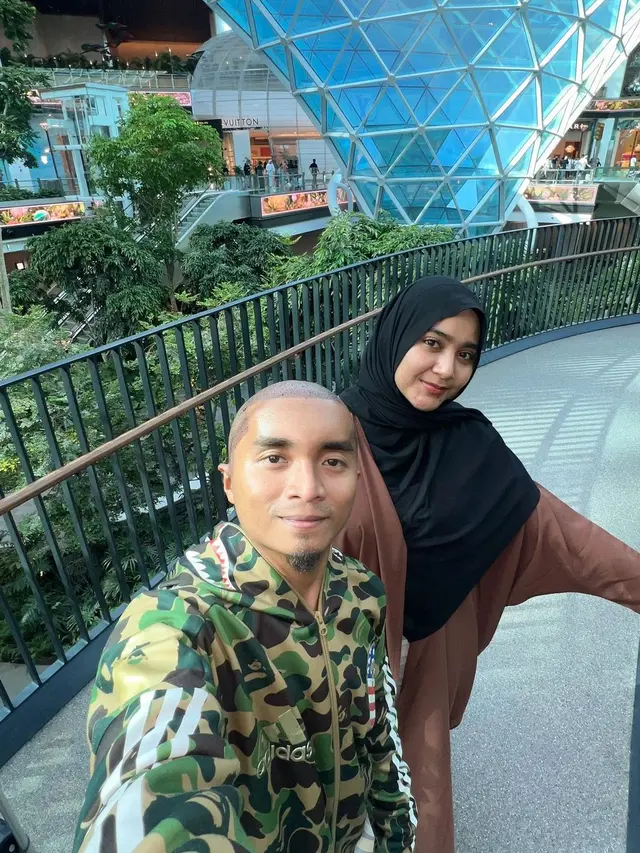 7 Potret Taqy Malik yang Kini Botak Usai Tanam Rambut di Turki