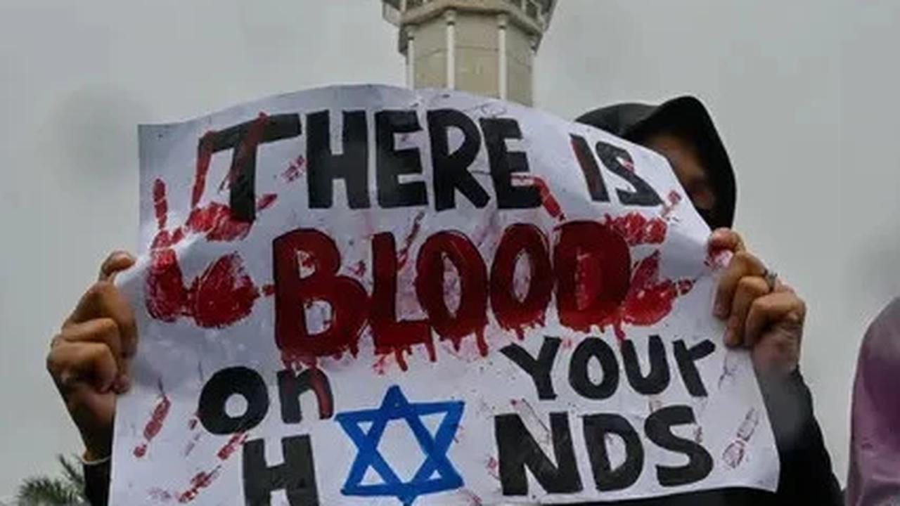 Startup Pakistan Kirim Kaki Prostetik untuk Anak Gaza Korban Serangan Israel