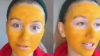 Niat Bikin Glowing, Wajah Gadis Ini Jadi Kuning Usai Pakai Masker Kunyit