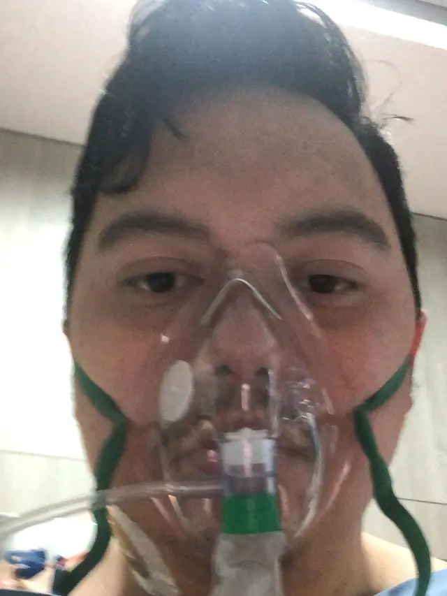 Chandra Liow Juga Sempat Alami Badai Sitokin Hingga Kritis dan Putusa Asa. (instagram.com/chandraliow)