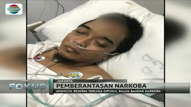 Brigadir Rizal Taufik, polisi korban pengeroyokan bandar narkoba di kawasan Jakarta Utara masih menjalani perawatan di rumah sakit.