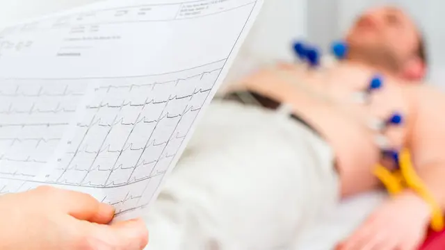 4 Penyebab Tersering Stroke di Usia Muda