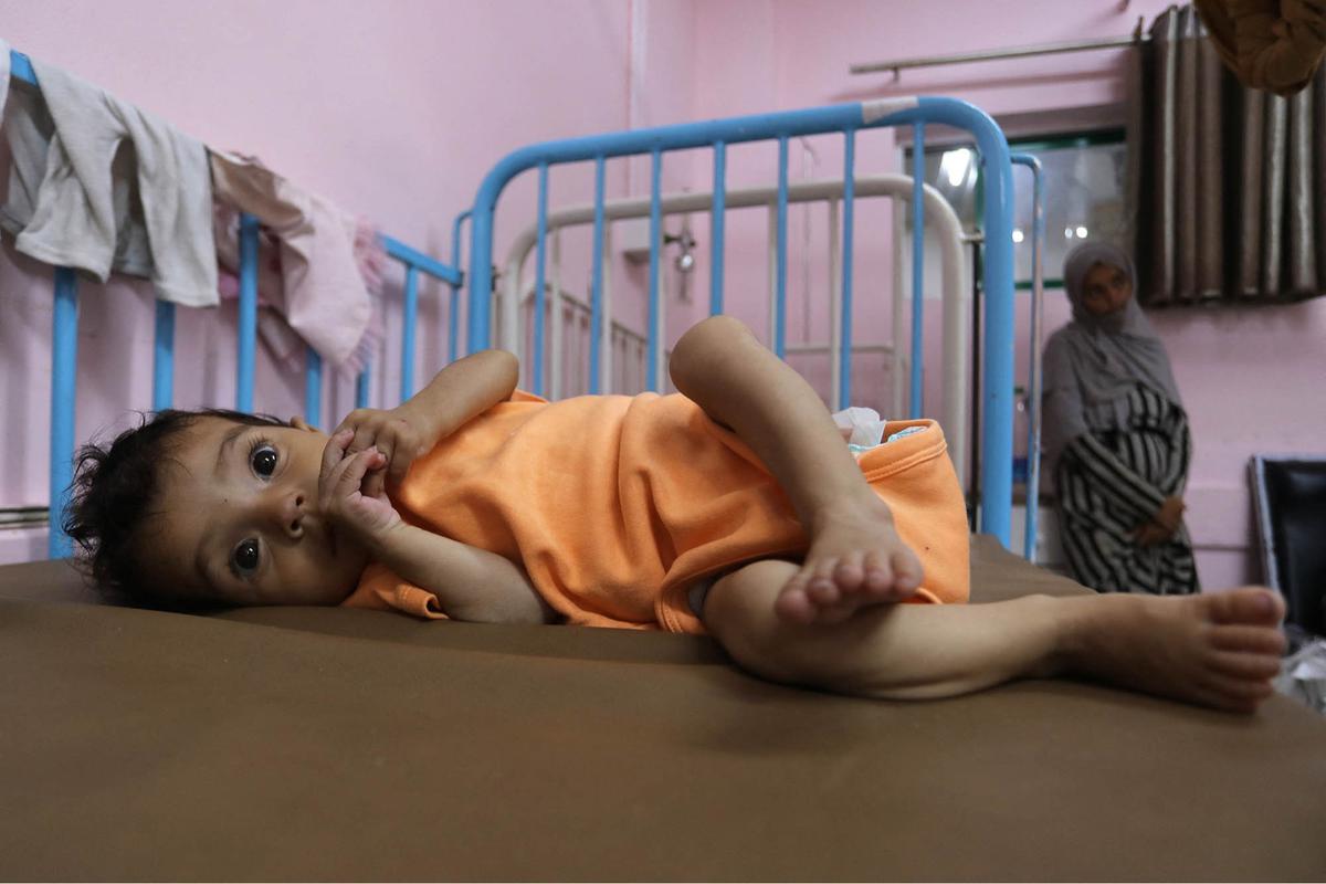 FOTO: Tubuh Kecil yang Lapar, Potret Pedih Bayi Gaza di Tengah Ancaman Kelaparan Massal