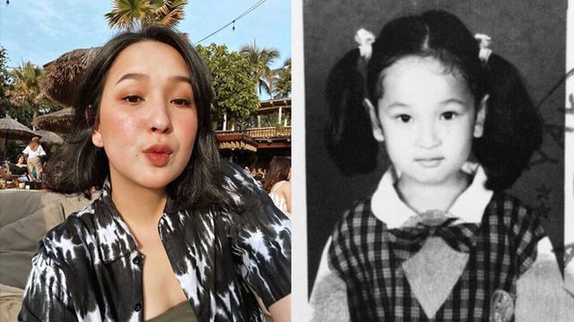 Foto Masa Kecil 5 Personel Eks Blink Imut Menggemaskan Hot Liputan6 Com