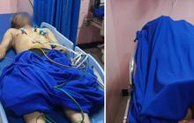 Tragedi Gas Tangki Air Jagakarsa: Empat Pekerja Tewas, Tiga Sesak Napas di Proyek TB Simatupang