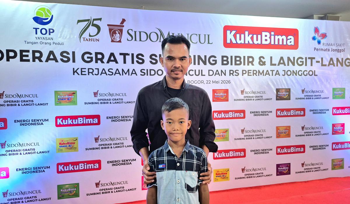 Pasien Operasi Bibir Sumbing