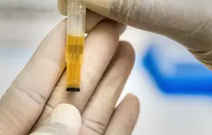 7 Warna Urine dan Artinya yang Perlu Anda Tahu
