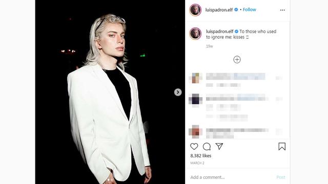 Pria Argentina Jalani 32 Operasi demi Mirip Peri