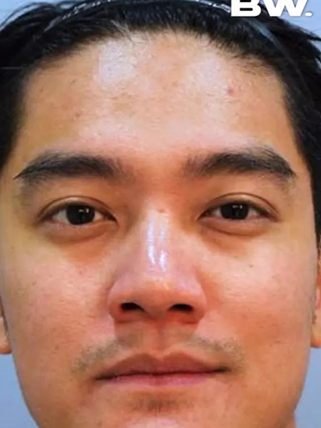 Boy William mengaku lakukan operasi hidung (Instagram/boywilliam17)