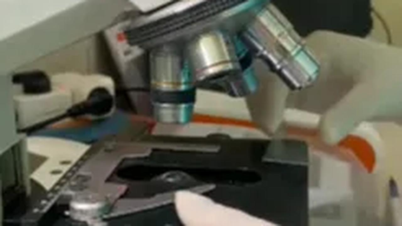 Video yang memperlihatkan potret setetes sel sperma menggunakan mikroskop berhasil mencuri perhatian. <br>