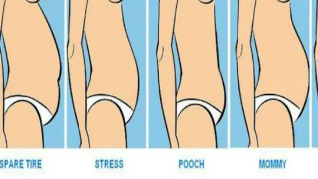 Ilustrasi tipe perut buncit/positivemed.com