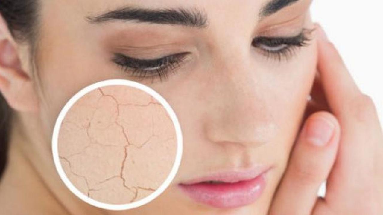 Kulit wajah kering