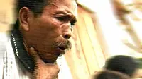 Kalau Batuk Periksalah, Siapa Tahu Tuberkulosis!