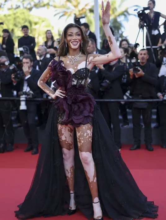 Winnie Harlow tampak anggun memamerkan kakinya dalam balutan gaun hitam Zuhair Murad yang panjangnya mencapai lantai. (Photo by Vianney Le Caer/Invision/AP)