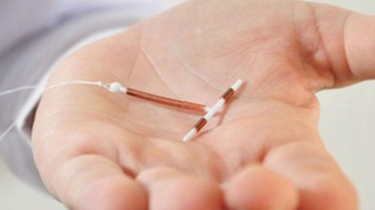 Jenis–jenis Kontrasepsi IUD