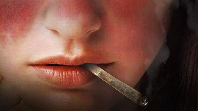 5 Obat Tradisional Penyakit Lupus Bantu Kurangi Gejalanya Hot Liputan6 Com