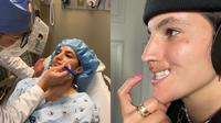 Brooklinn Khoury, Wanita yang Viral karena Bibirnya Diseruduk Anjing Pit Bull hingga Harus Operasi Berkali-kali (Instagram/brookhoury)