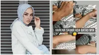 Medina bongkar tindakan KDRT suaminya di media sosial. (Sumber: Instagram/medinazein)