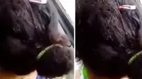 Geli, Ribuan Kutu Beranak-pinak di Kepala Wanita Ini