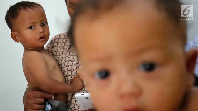 Gejala TBC pada Anak, Biaya Tes Hingga Hal yang Perlu Orang Tua Pahami