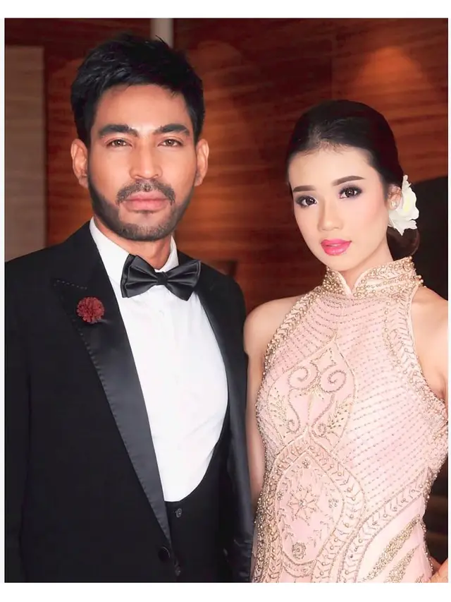 Jalani Suntik Botoks, Ini 7 Potret Terbaru Robby Purba