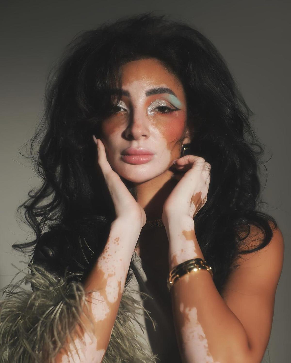 Potret Cantik Logina Salah, Miss Universe Mesir Pertama dengan Vitiligo dan Status Ibu