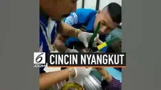 Seorang wanita mendatangi sebuah rumah sakit di distrik Mueng, Loey, Thailand untuk membantunya melepaskan cincin. Jarinya membengkak setelah 30 tahun mengenakan cincin yang sempit.