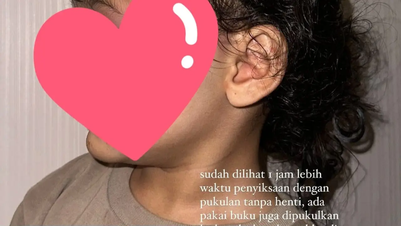 Penganiayaan Pengasuh ke Anak Selebgram Aghnia Terjadi di Jam 4-5 Pagi