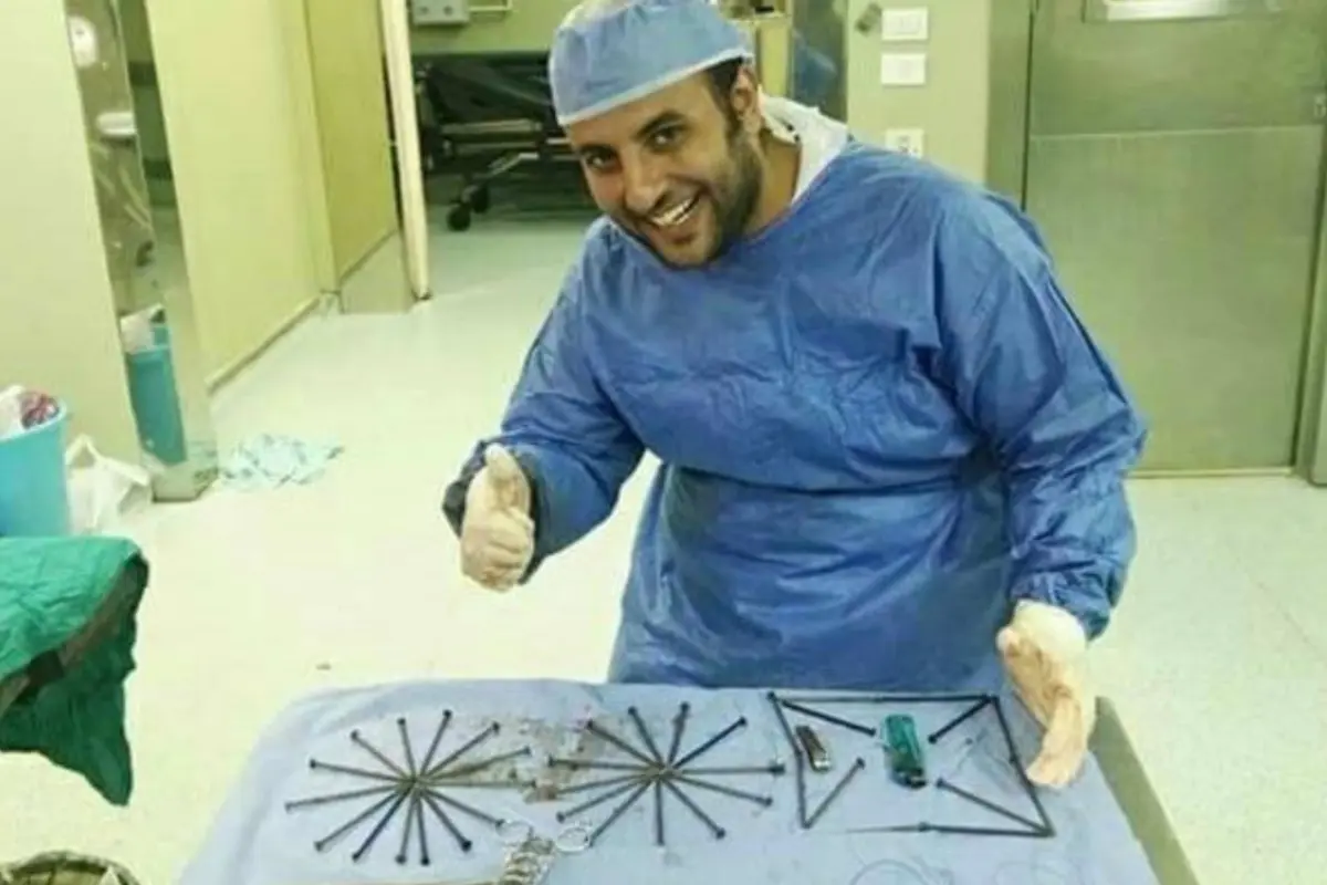 Dokter di Rumah Sakit Qasr El Eyni, Abdelrahman Mostafa yang menemukan 39 paku di perut pasien. (Facebook)