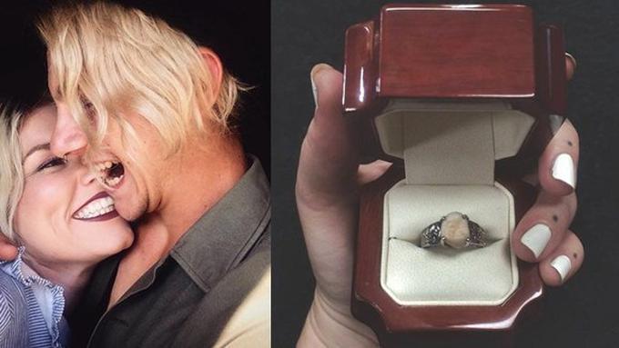 Cincin Tunangan  Wanita Ini Adalah  Gigi Geraham Tunangannya 