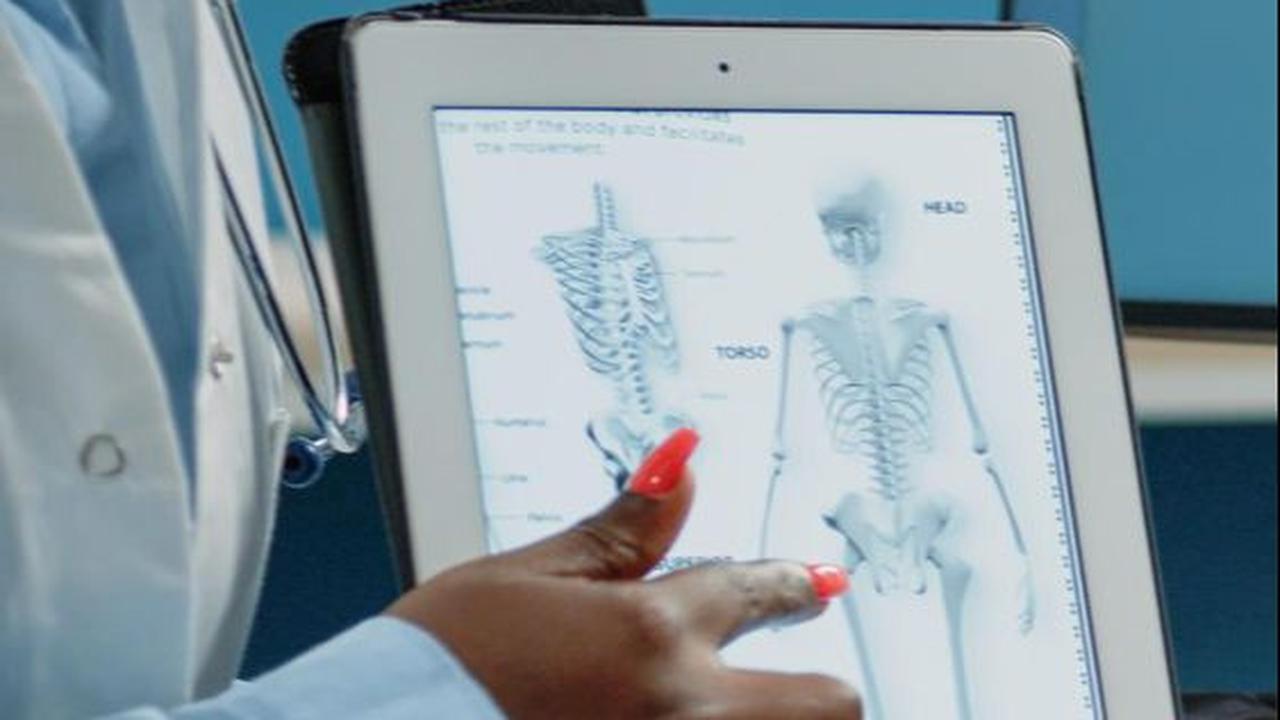 Cara Mencegah Osteoporosis Sejak Usia Muda, Jangan Tunda Nanti