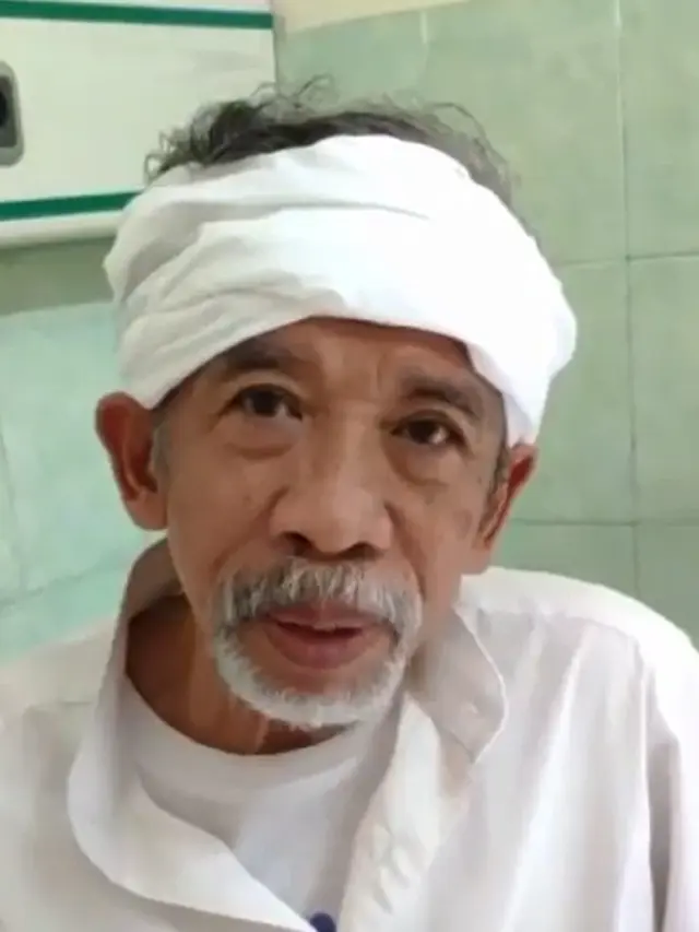 Komedian Nurul Qomar berjuang melawan kanker usus, kini terbaring di rumah sakit, begini kondisinya