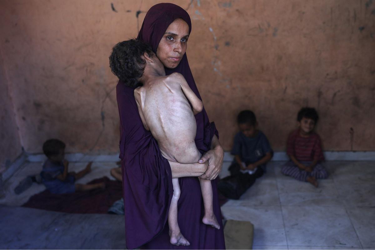 FOTO: Tubuh Kecil yang Lapar, Potret Pedih Bayi Gaza di Tengah Ancaman Kelaparan Massal