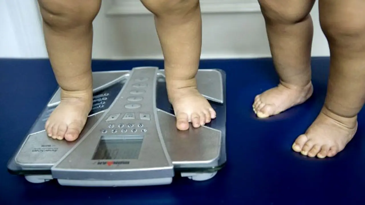 anak-obesitas-130910b.jpg