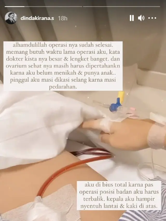 6 Potret Kondisi Terbaru Dinda Kirana Pasca Operasi Pengangkatan Kista Ovarium