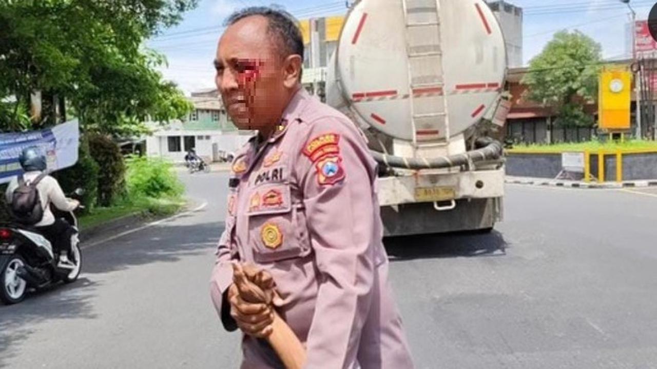 Kondisi Ipda Purnomo Polisi Baik Dipukul ODGJ Hingga Berdarah-darah, Didorong Terbaring Masuk IGD RS