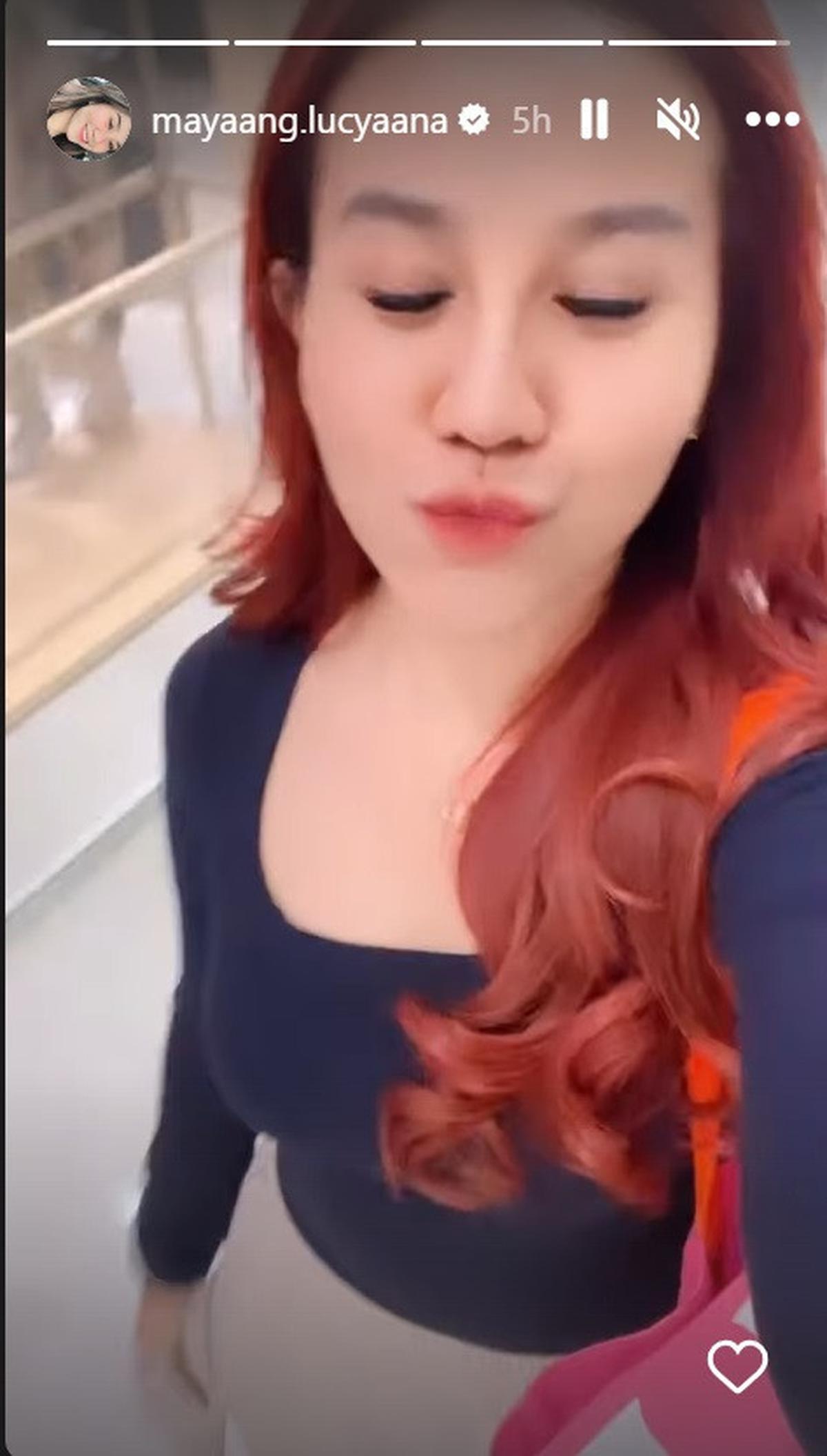 Hasil Operasi Hidung yang Ke dua