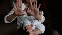 Seorang bayi lahir dengan jari tangan berjumlah 15, dan kaki 16 (Foto:Mirror.com)