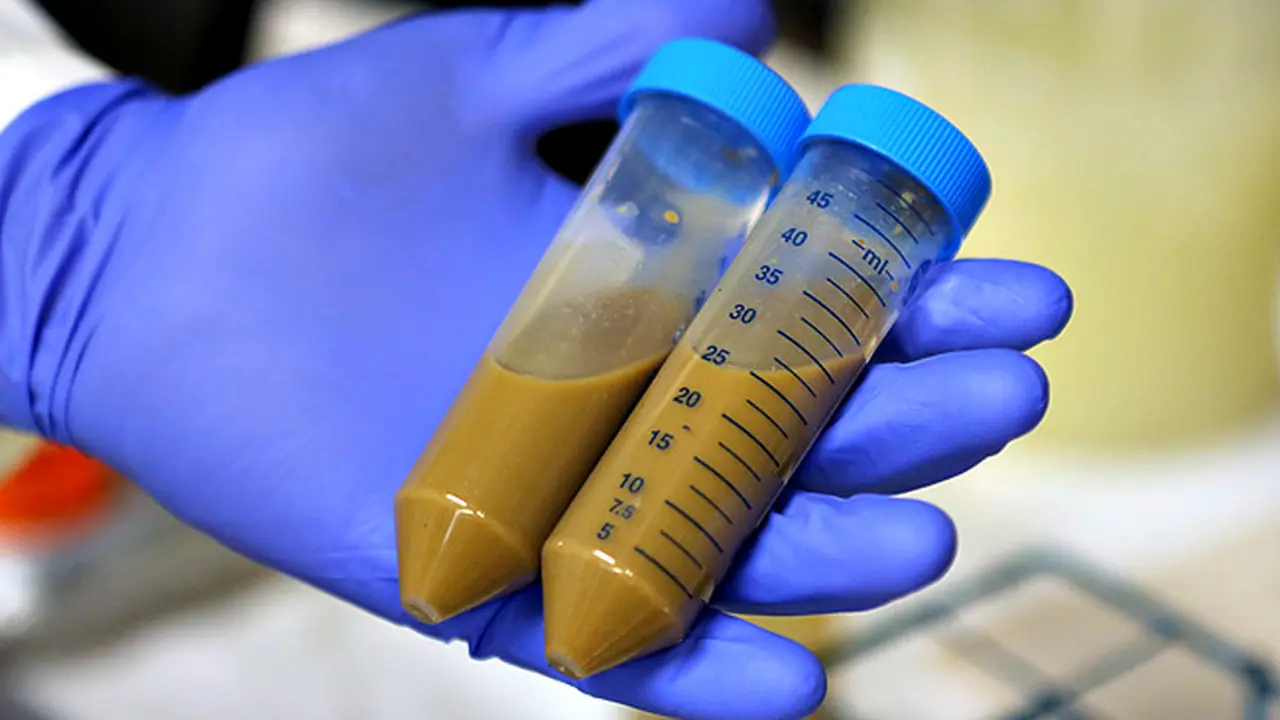 Transplantasi Tinja Untuk Sembuhkan Radang Usus Besar